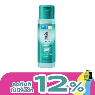 Hada Labo - Hada Labo Blemish  Oil Control Hydrating Lotion 170 Ml.